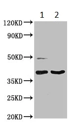 Western blot - Anti-LGALS12 antibody (AB235039)