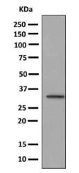 Western blot - Anti-LGALS14 antibody [EPR9665] (AB150427)