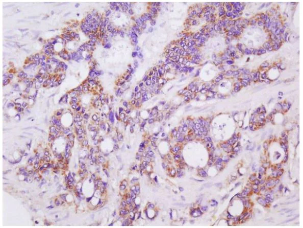 Immunohistochemistry (Formalin/PFA-fixed paraffin-embedded sections) - Anti-LGALS3BP antibody (AB217760)