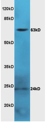 Western blot - Anti-LGALS3BP antibody (AB217760)