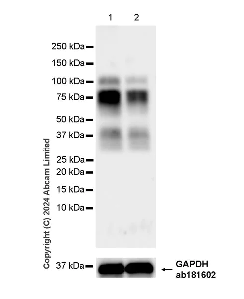 Western blot - Anti-LGALS3BP antibody [EPR26644-269] (AB322977)
