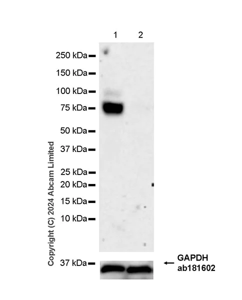 Western blot - Anti-LGALS3BP antibody [EPR26644-269] (AB322977)