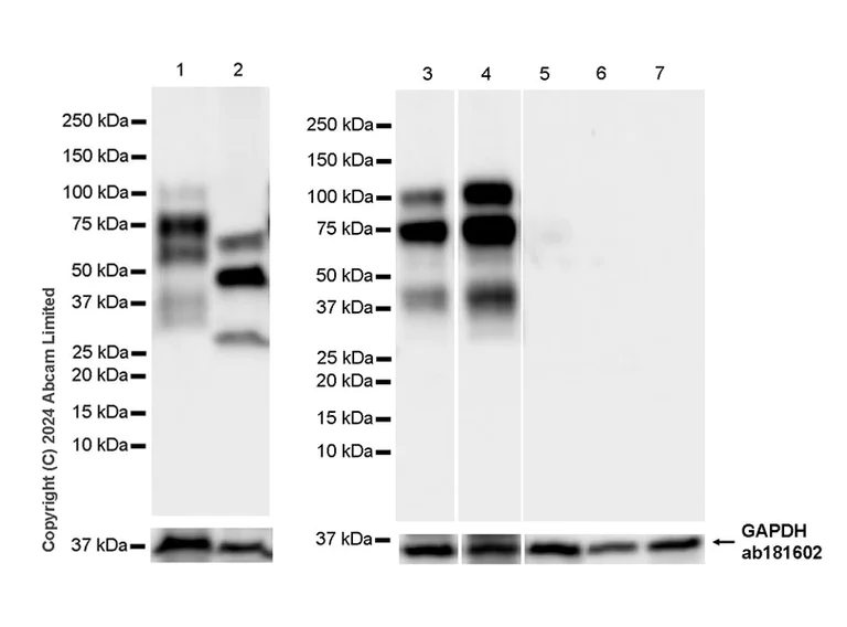 Western blot - Anti-LGALS3BP antibody [EPR26644-269] (AB322977)