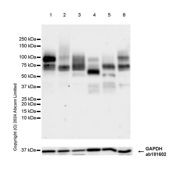 Western blot - Anti-LGALS3BP antibody [EPR26644-269] (AB322977)