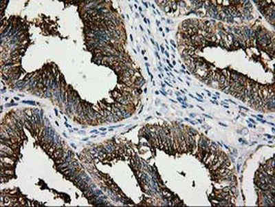 Immunohistochemistry (Formalin/PFA-fixed paraffin-embedded sections) - Anti-LGALS3BP antibody [OTI3D6] (AB236509)
