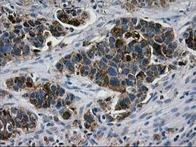 Immunohistochemistry (Formalin/PFA-fixed paraffin-embedded sections) - Anti-LGALS3BP antibody [OTI3D6] (AB236509)