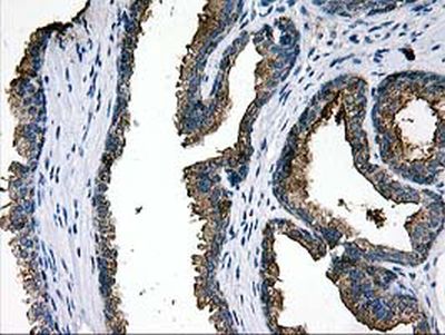 Immunohistochemistry (Formalin/PFA-fixed paraffin-embedded sections) - Anti-LGALS3BP antibody [OTI3D6] (AB236509)