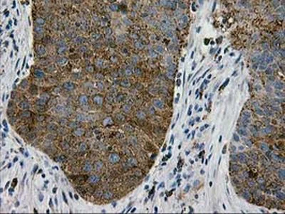 Immunohistochemistry (Formalin/PFA-fixed paraffin-embedded sections) - Anti-LGALS3BP antibody [OTI3D6] (AB236509)