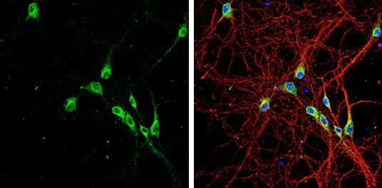Immunocytochemistry/ Immunofluorescence - Anti-Lgi1/EPT antibody (AB228613)