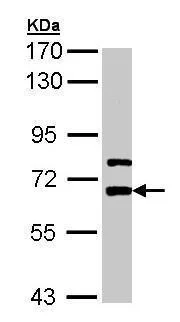Western blot - Anti-Lgi1/EPT antibody (AB228613)