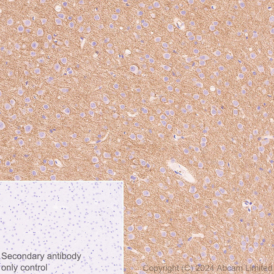 Immunohistochemistry (Formalin/PFA-fixed paraffin-embedded sections) - Anti-Lgi1/EPT antibody [EPR9084] (ab137045), expandable thumbnail