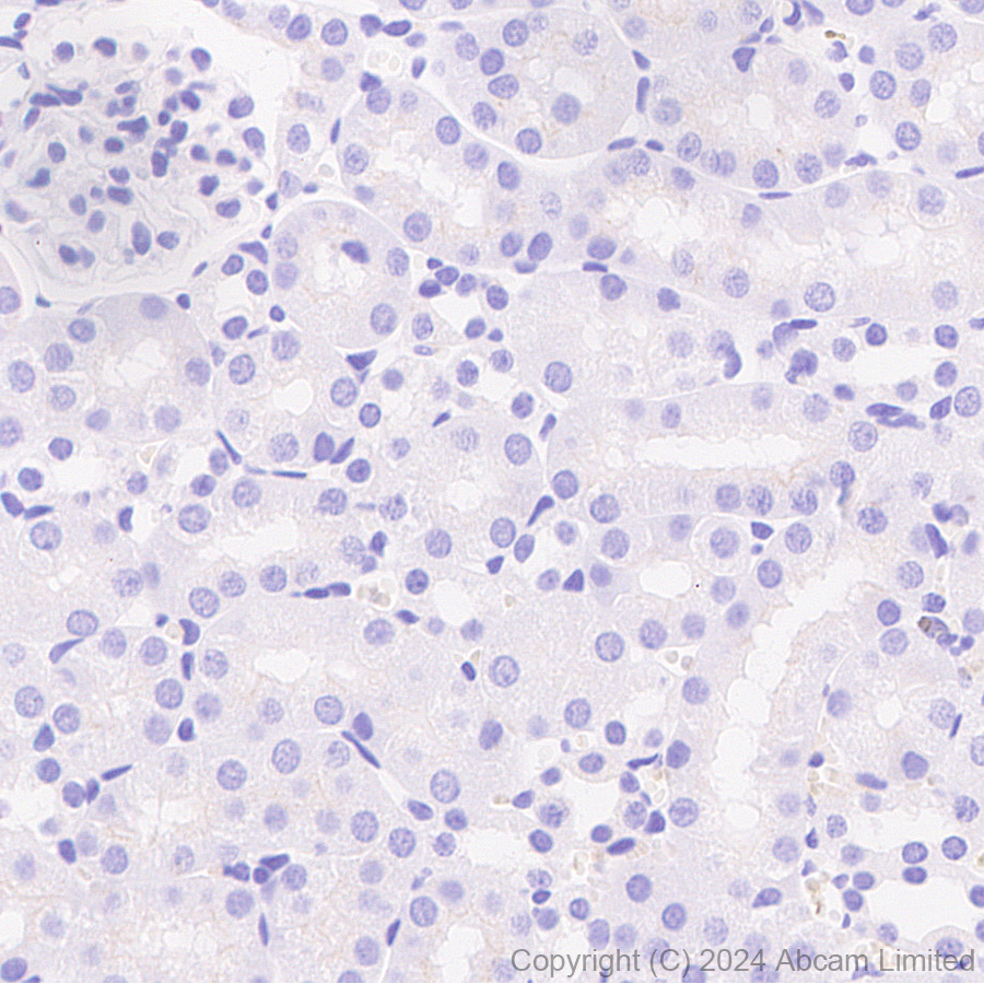 Immunohistochemistry (Formalin/PFA-fixed paraffin-embedded sections) - Anti-Lgi1/EPT antibody [EPR9084] (ab137045), expandable thumbnail