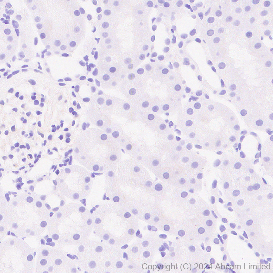 Immunohistochemistry (Formalin/PFA-fixed paraffin-embedded sections) - Anti-Lgi1/EPT antibody [EPR9084] (AB137045), expandable thumbnail