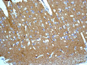Immunohistochemistry (Formalin/PFA-fixed paraffin-embedded sections) - Anti-Lgi1/EPT antibody [EPR9084] (AB137045), expandable thumbnail