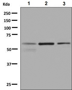 Western blot - Anti-Lgi1/EPT antibody [EPR9084] (AB137045), expandable thumbnail