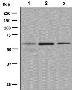 Western blot - Anti-Lgi1/EPT antibody [EPR9084] (AB137045)