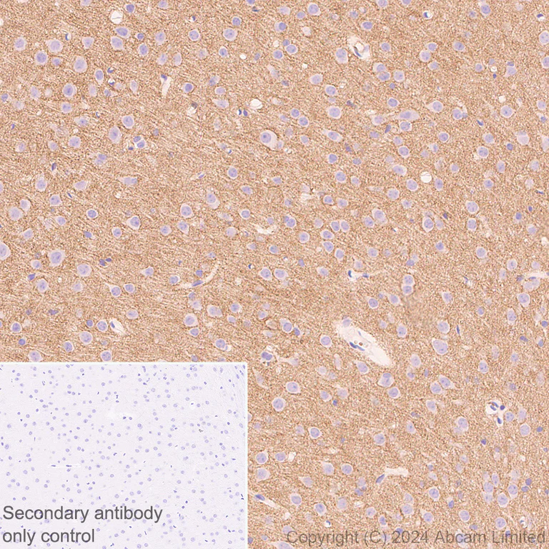 Immunohistochemistry (Formalin/PFA-fixed paraffin-embedded sections) - Anti-Lgi1/EPT antibody [EPR9084] - BSA and Azide free (AB240101)