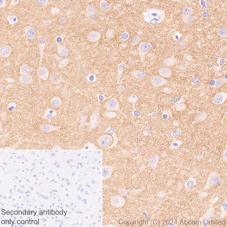 Immunohistochemistry (Formalin/PFA-fixed paraffin-embedded sections) - Anti-Lgi1/EPT antibody [EPR9084] - BSA and Azide free (AB240101)