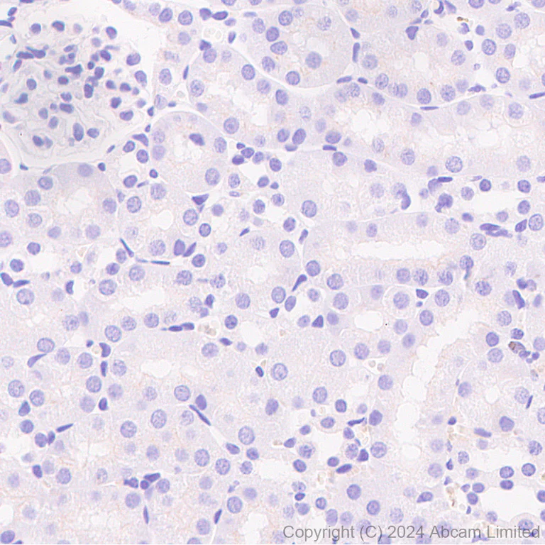 Immunohistochemistry (Formalin/PFA-fixed paraffin-embedded sections) - Anti-Lgi1/EPT antibody [EPR9084] - BSA and Azide free (AB240101)