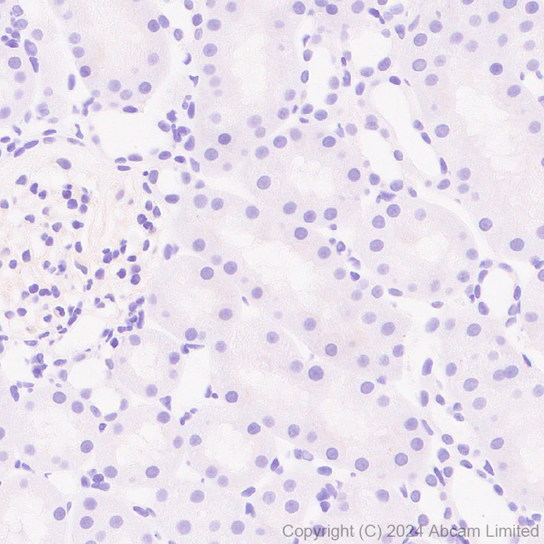 Immunohistochemistry (Formalin/PFA-fixed paraffin-embedded sections) - Anti-Lgi1/EPT antibody [EPR9084] - BSA and Azide free (AB240101)