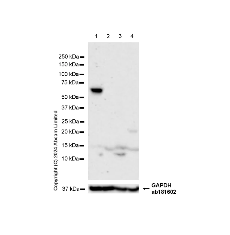 Western blot - Anti-Lgi1/EPT antibody [EPR9084] - BSA and Azide free (AB240101)