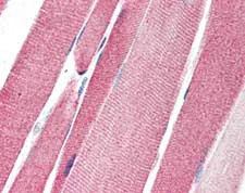 Immunohistochemistry (Formalin/PFA-fixed paraffin-embedded sections) - Anti-Lgi4 antibody (AB115305)