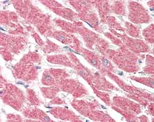 Immunohistochemistry (Formalin/PFA-fixed paraffin-embedded sections) - Anti-Lgi4 antibody (AB115305)