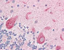 Immunohistochemistry (Formalin/PFA-fixed paraffin-embedded sections) - Anti-Lgi4 antibody (AB115305)