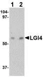 Western blot - Anti-Lgi4 antibody (AB115305)