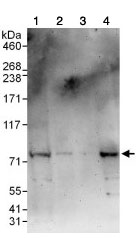 Western blot - Anti-LGN antibody (AB109594), expandable thumbnail