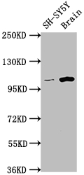 Western blot - Anti-LGR5 antibody [4H8] (AB314009), expandable thumbnail