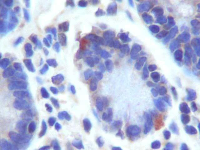 Immunohistochemistry (Formalin/PFA-fixed paraffin-embedded sections) - Anti-LGR5 antibody (AB261734)