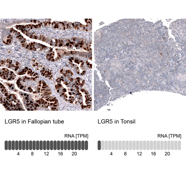 Immunohistochemistry (Formalin/PFA-fixed paraffin-embedded sections) - Anti-LGR5 Antibody [CL13567] (AB327149)