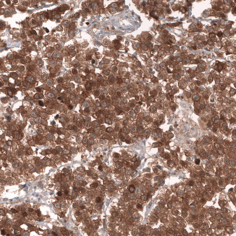 Immunohistochemistry (Formalin/PFA-fixed paraffin-embedded sections) - Anti-LGR5 Antibody [CL13567] (AB327149)