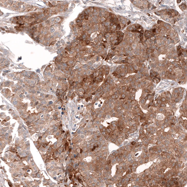 Immunohistochemistry (Formalin/PFA-fixed paraffin-embedded sections) - Anti-LGR5 Antibody [CL13567] (AB327149)