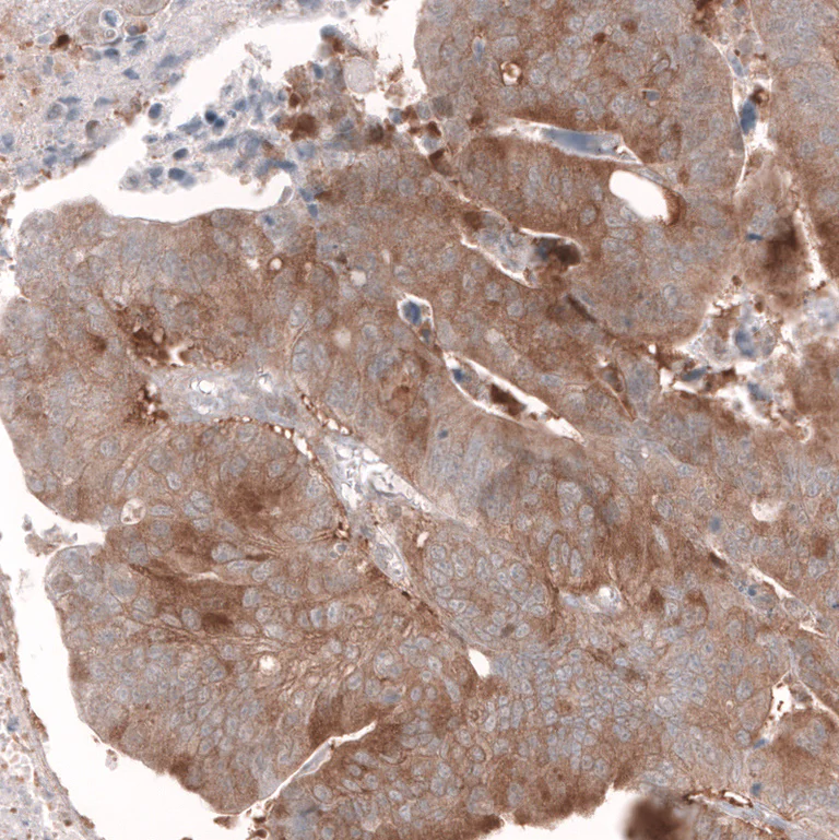 Immunohistochemistry (Formalin/PFA-fixed paraffin-embedded sections) - Anti-LGR5 Antibody [CL13567] (AB327149)
