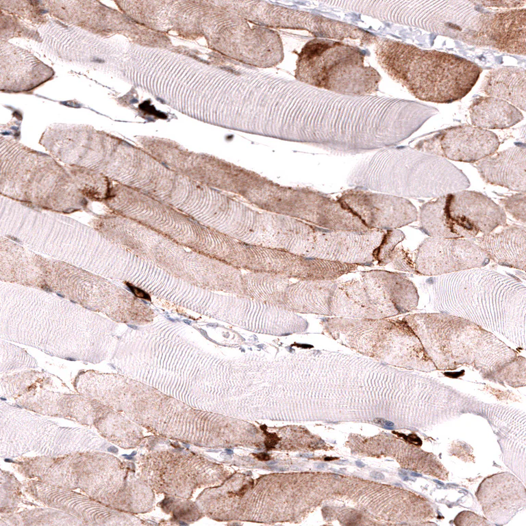 Immunohistochemistry (Formalin/PFA-fixed paraffin-embedded sections) - Anti-LGR5 Antibody [CL13567] (AB327149)