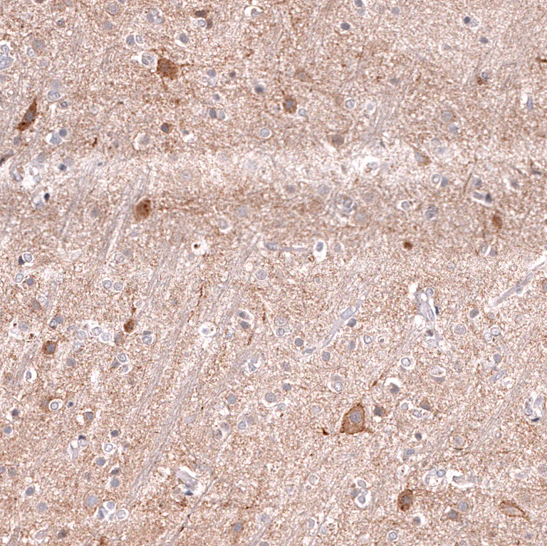 Immunohistochemistry (Formalin/PFA-fixed paraffin-embedded sections) - Anti-LGR5 Antibody [CL13567] (AB327149)