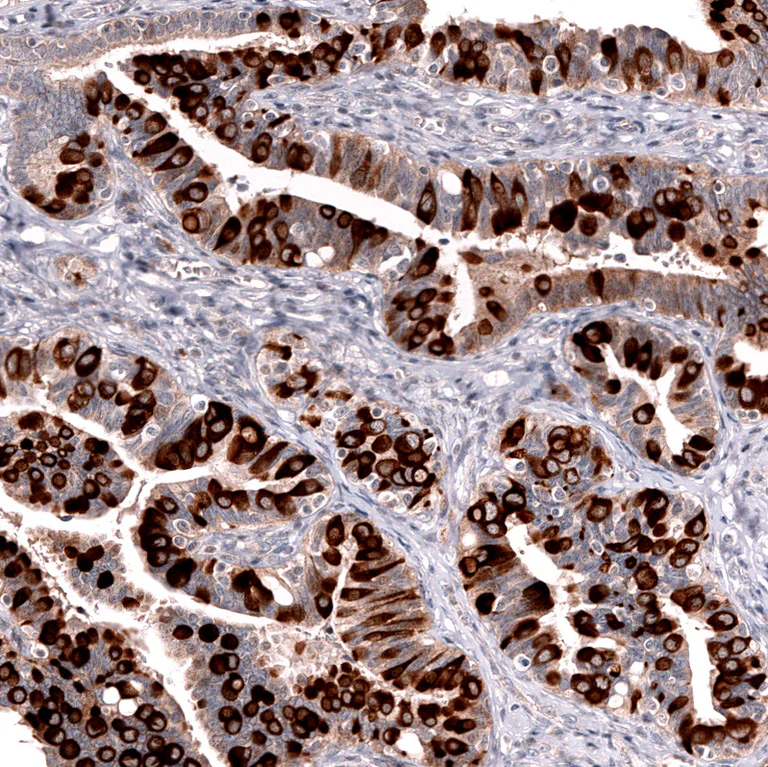 Immunohistochemistry (Formalin/PFA-fixed paraffin-embedded sections) - Anti-LGR5 Antibody [CL13567] (AB327149)