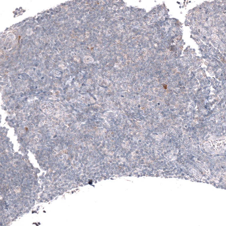 Immunohistochemistry (Formalin/PFA-fixed paraffin-embedded sections) - Anti-LGR5 Antibody [CL13567] (AB327149)