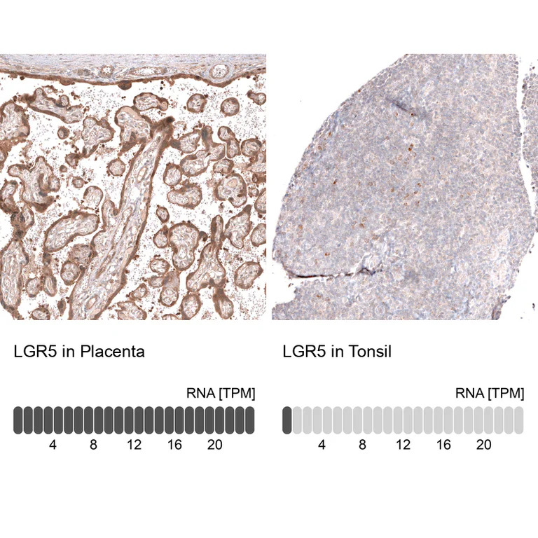 Immunohistochemistry (Formalin/PFA-fixed paraffin-embedded sections) - Anti-LGR5 Antibody [CL13579] (AB327150)