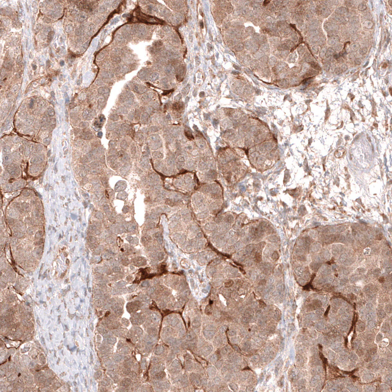 Immunohistochemistry (Formalin/PFA-fixed paraffin-embedded sections) - Anti-LGR5 Antibody [CL13579] (AB327150)