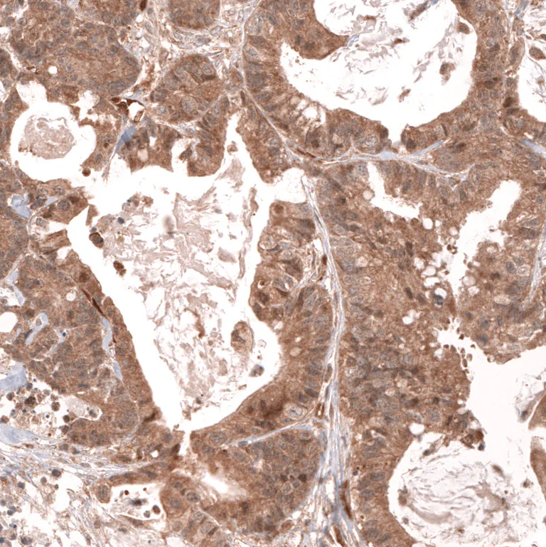 Immunohistochemistry (Formalin/PFA-fixed paraffin-embedded sections) - Anti-LGR5 Antibody [CL13579] (AB327150)