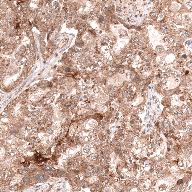 Immunohistochemistry (Formalin/PFA-fixed paraffin-embedded sections) - Anti-LGR5 Antibody [CL13579] (AB327150)