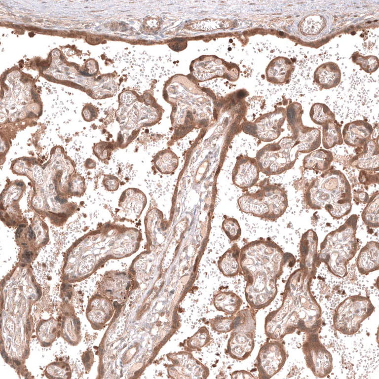 Immunohistochemistry (Formalin/PFA-fixed paraffin-embedded sections) - Anti-LGR5 Antibody [CL13579] (AB327150)