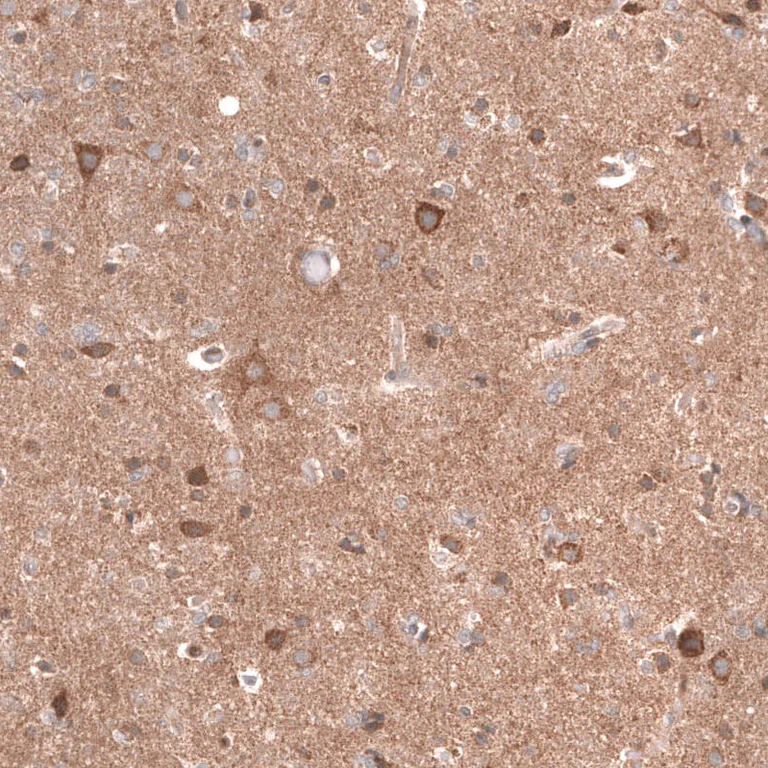 Immunohistochemistry (Formalin/PFA-fixed paraffin-embedded sections) - Anti-LGR5 Antibody [CL13579] (AB327150)