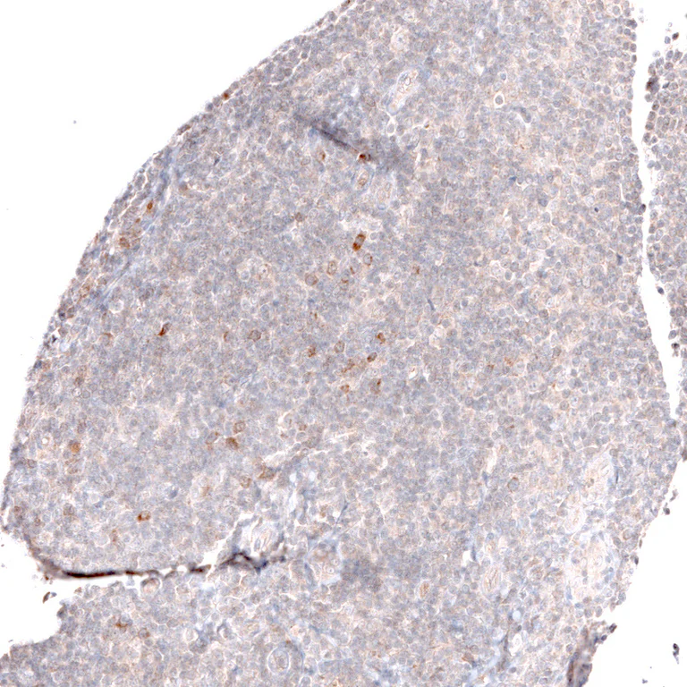 Immunohistochemistry (Formalin/PFA-fixed paraffin-embedded sections) - Anti-LGR5 Antibody [CL13579] (AB327150)