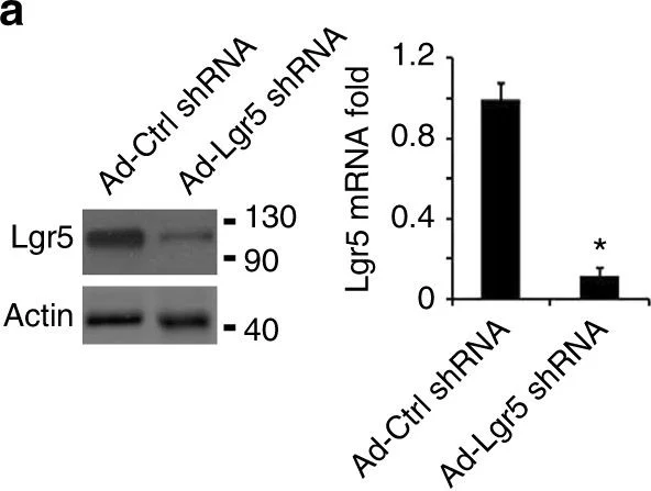 Western blot - Anti-LGR5 antibody [EPR3065Y] (AB75850)
