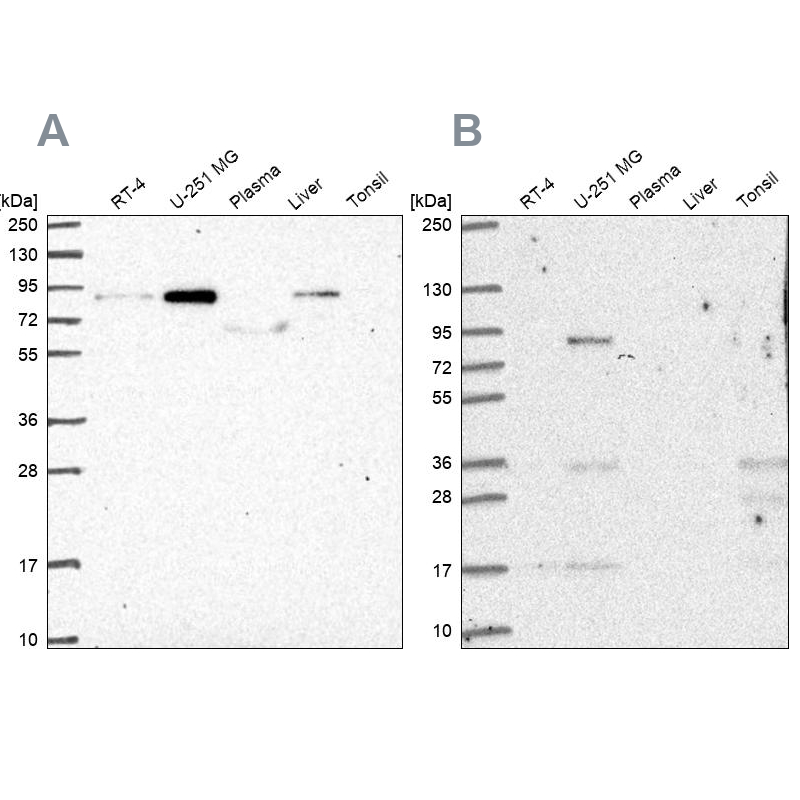 Western blot - Anti-LH1 antibody (AB262946)