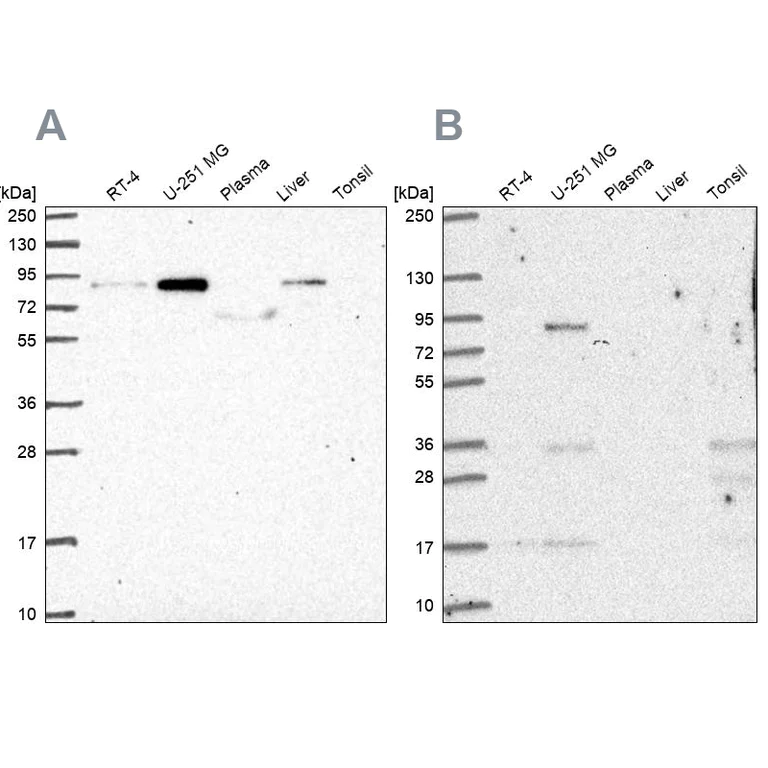 Western blot - Anti-LH1 antibody (AB262946)